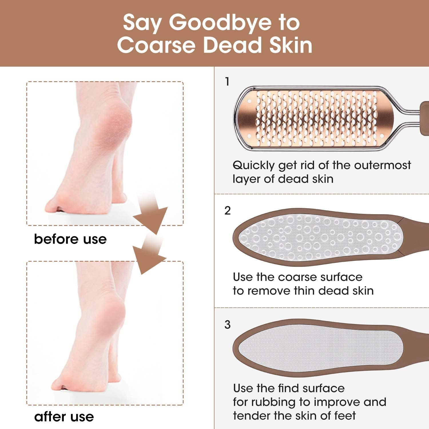 2PCS Foot File Rasp Set — Callus & Cracked Skin Remover